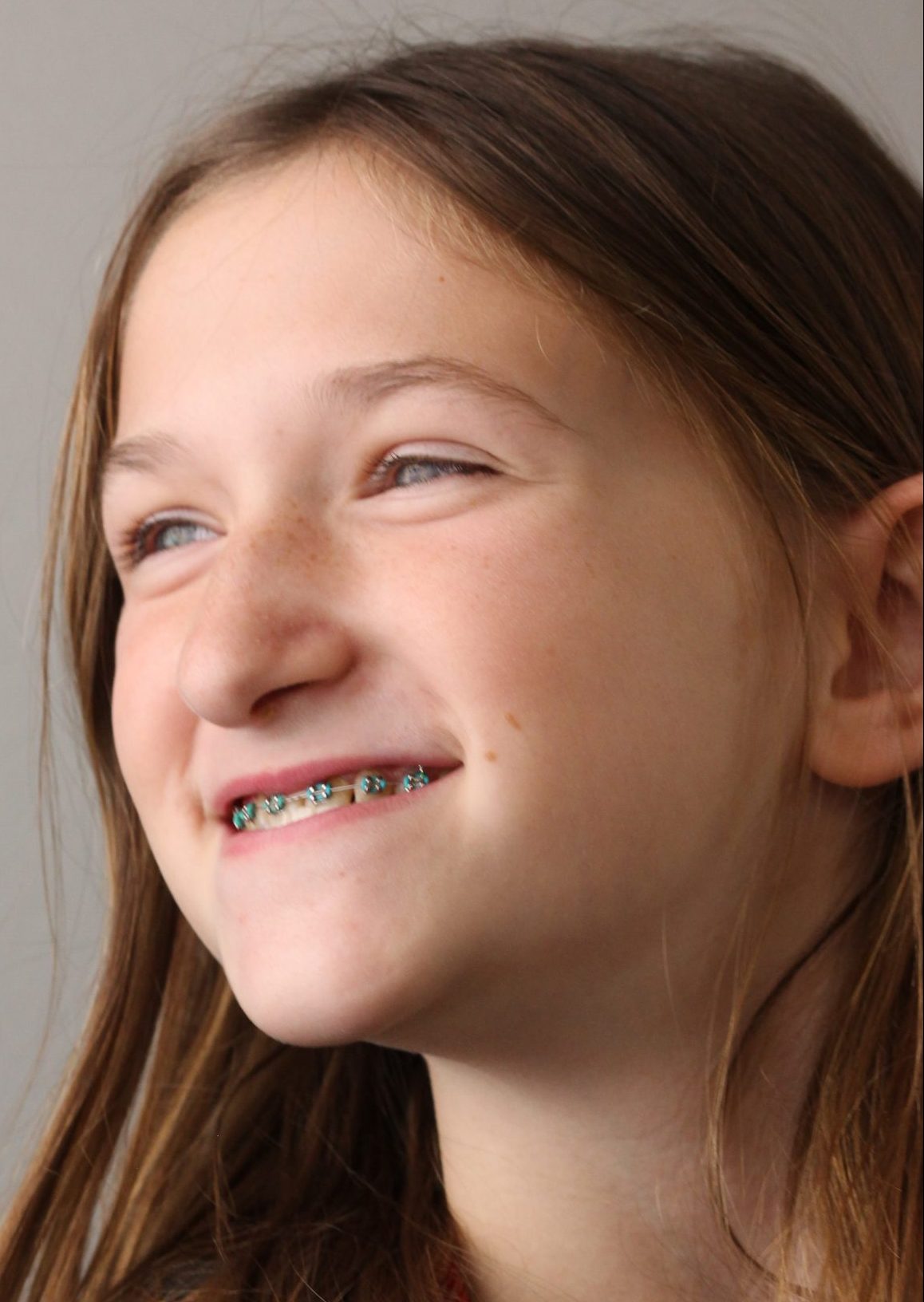 a young girl in braces
